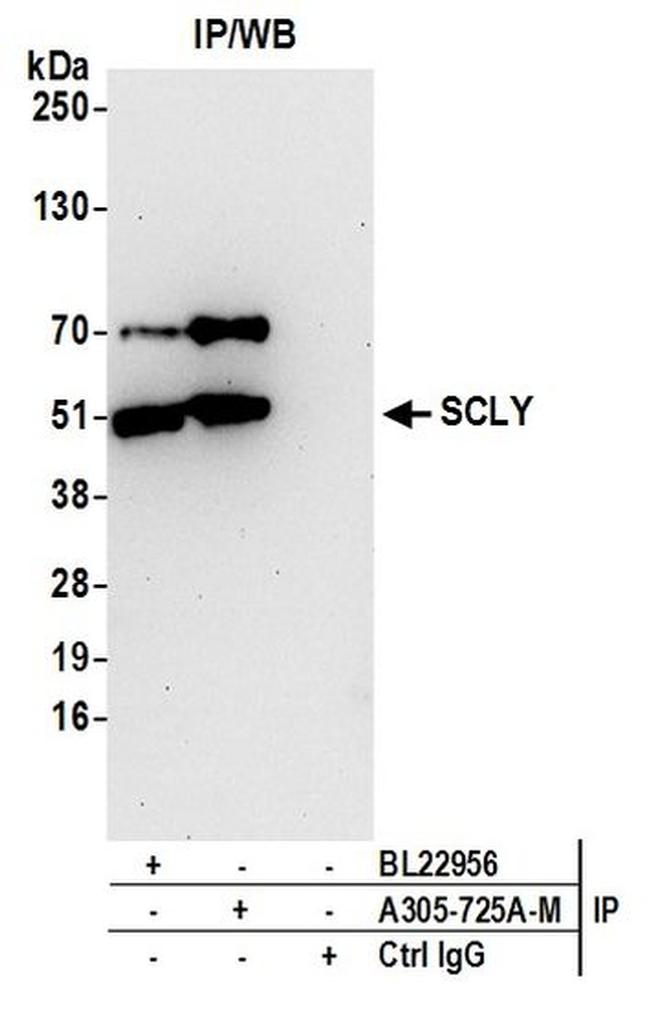 SCLY Antibody in Western Blot (WB)