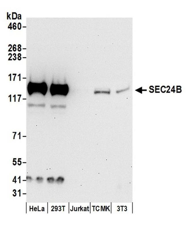 SEC24B Antibody in Western Blot (WB)