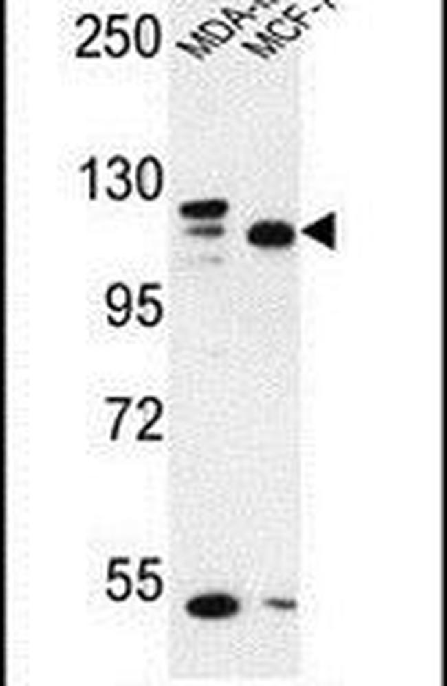 SEC24C Antibody in Western Blot (WB)