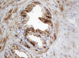 SELENBP1 Antibody in Immunohistochemistry (Paraffin) (IHC (P))