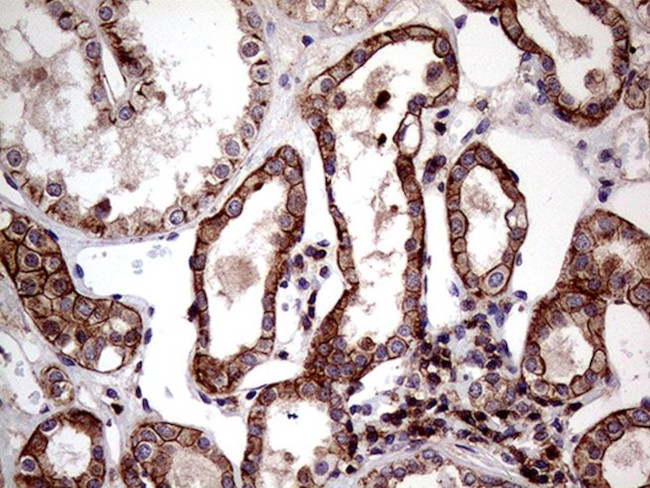 SEMA4D Antibody in Immunohistochemistry (Paraffin) (IHC (P))