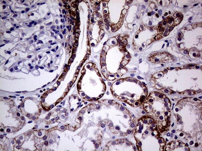 SEMA4D Antibody in Immunohistochemistry (Paraffin) (IHC (P))