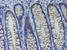 SENP2 Antibody in Immunohistochemistry (Paraffin) (IHC (P))