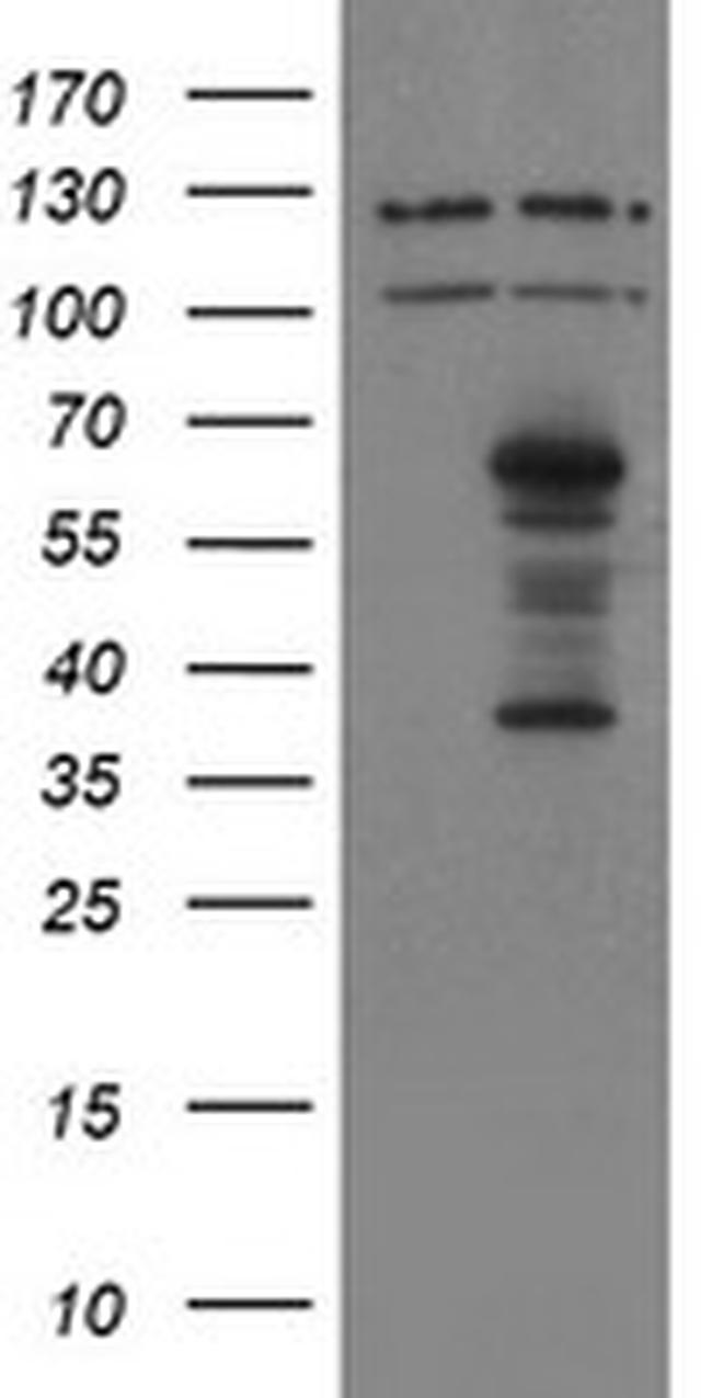 SENP2 Antibody in Western Blot (WB)