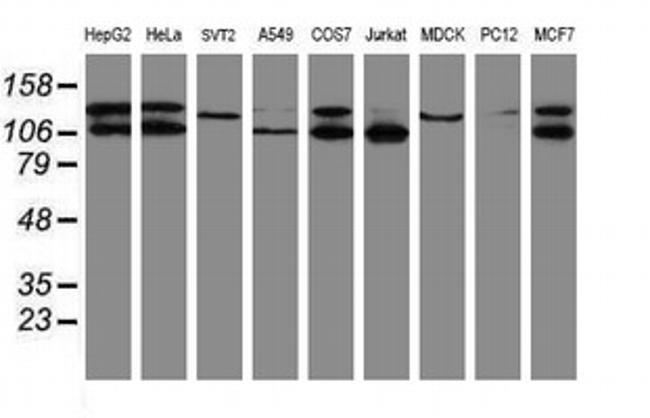 SENP2 Antibody in Western Blot (WB)