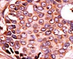 SEPHS2 Antibody in Immunohistochemistry (IHC)