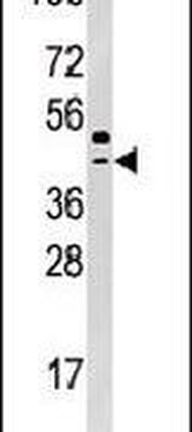 SEPHS2 Antibody in Western Blot (WB)