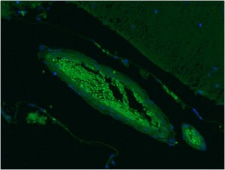 SEPT5 Antibody in Immunohistochemistry (Paraffin) (IHC (P))