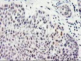 SERPINB13 Antibody in Immunohistochemistry (Paraffin) (IHC (P))