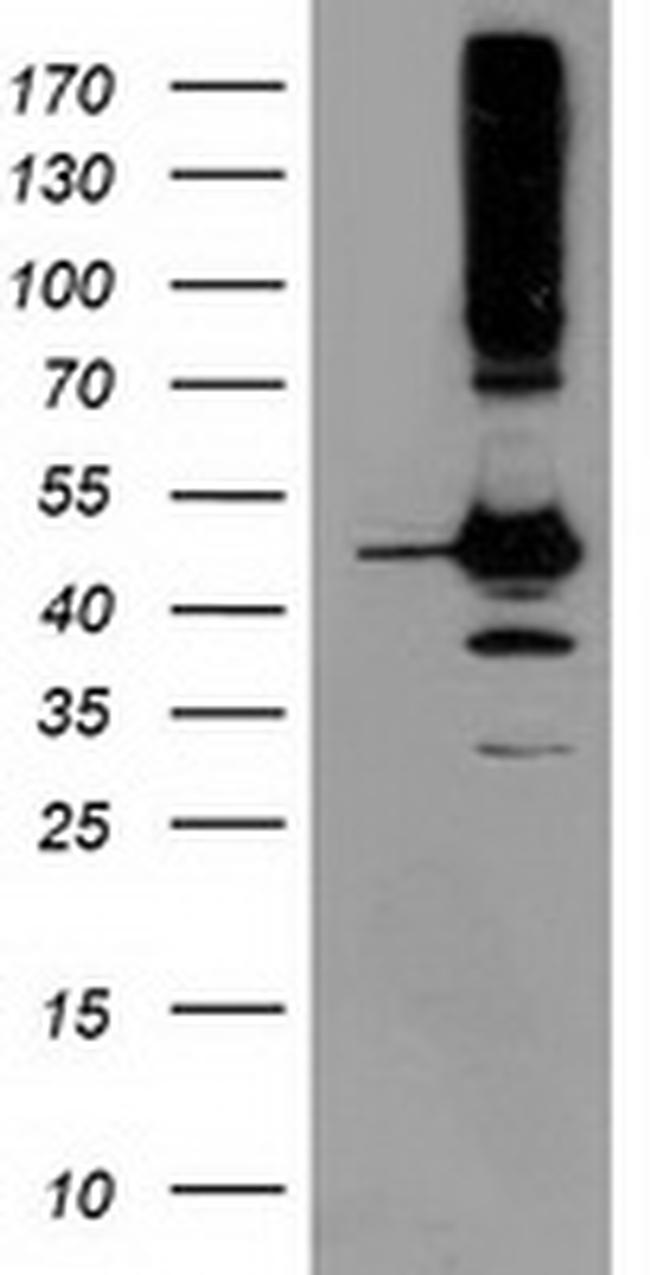 SERPINB13 Antibody in Western Blot (WB)