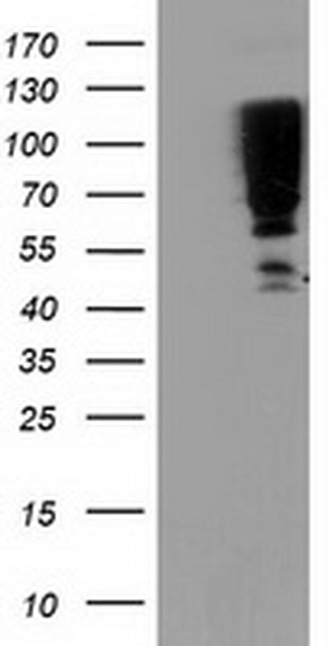 SERPINB13 Antibody in Western Blot (WB)