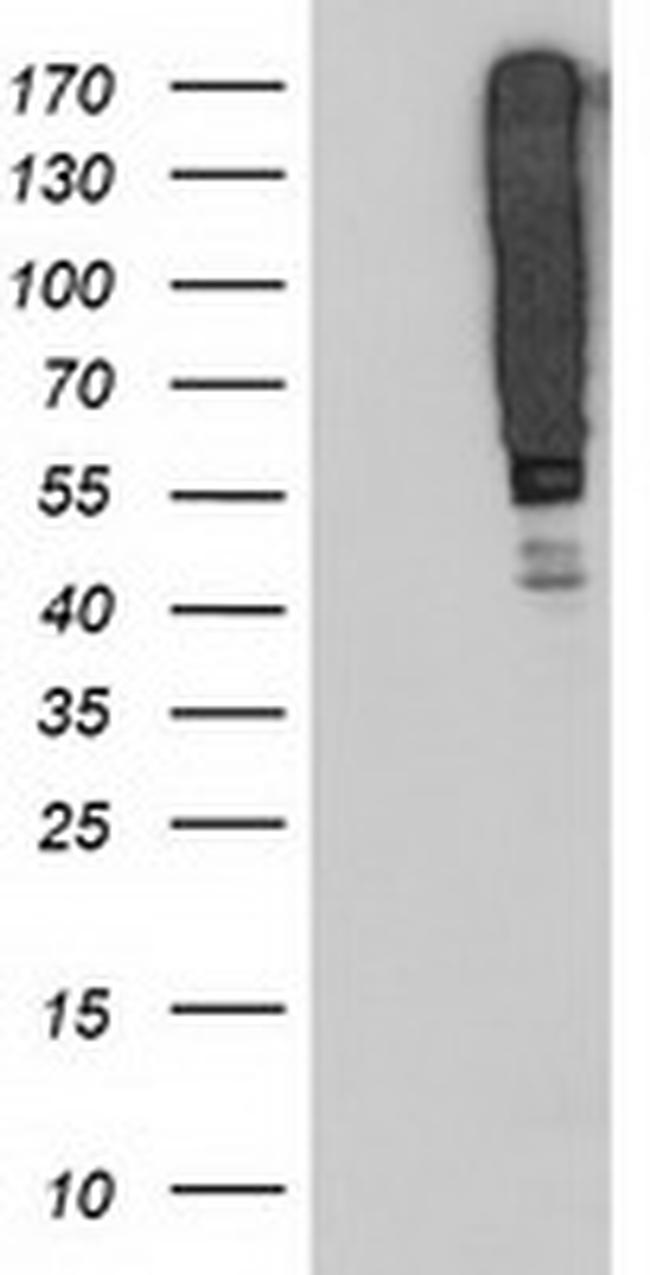 SERPINB13 Antibody in Western Blot (WB)