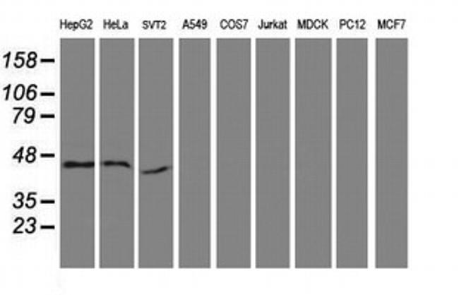 SERPINB13 Antibody in Western Blot (WB)