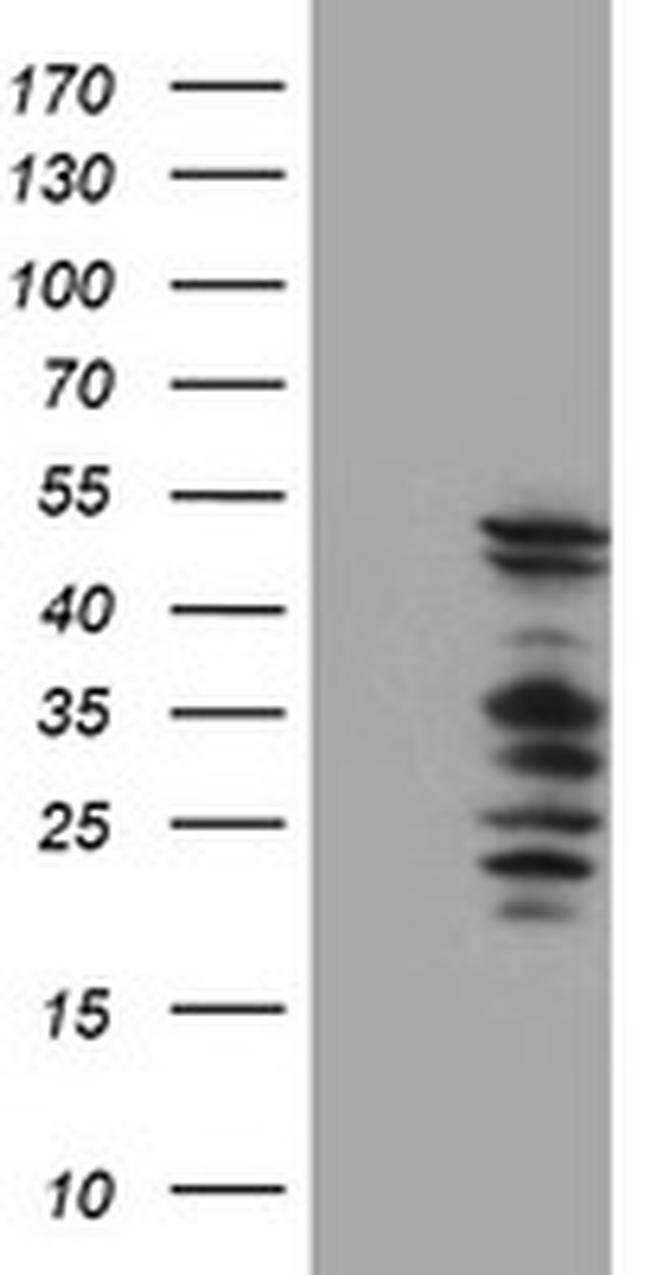 SERPINB2 Antibody in Western Blot (WB)