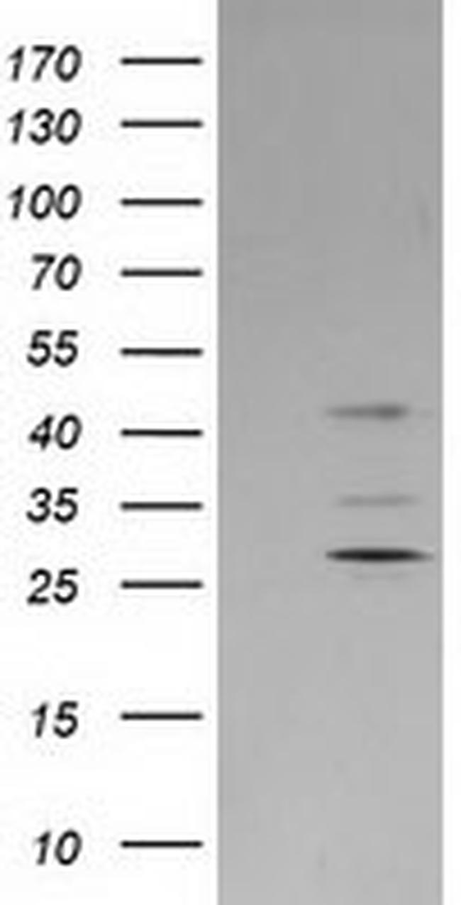SERPINB2 Antibody in Western Blot (WB)