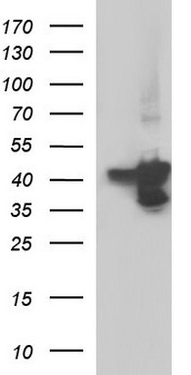 SERPINB3 Antibody in Western Blot (WB)