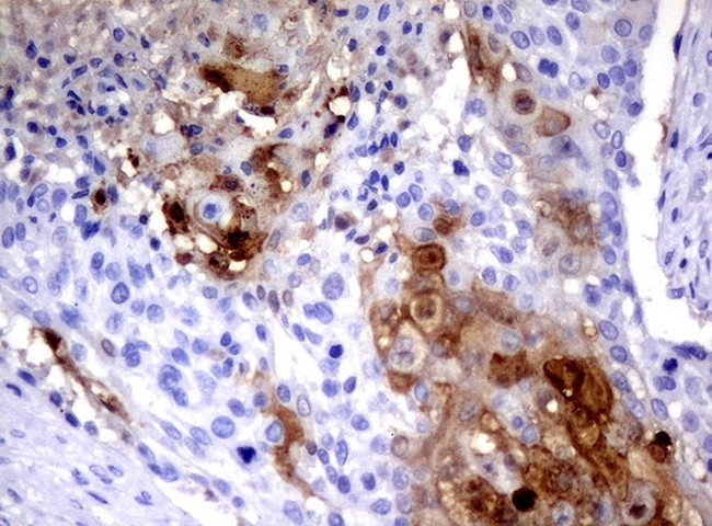 SERPINB4 Antibody in Immunohistochemistry (Paraffin) (IHC (P))