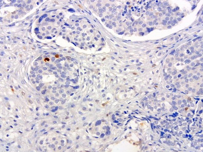 SERPINB4 Antibody in Immunohistochemistry (Paraffin) (IHC (P))