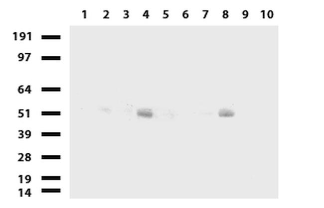 SERPINB4 Antibody in Western Blot (WB)