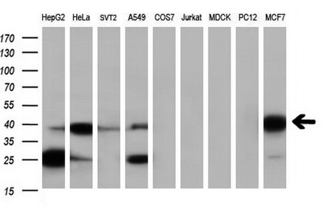 SERPINB6 Antibody in Western Blot (WB)