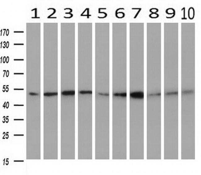 SERPINC1 Antibody in Western Blot (WB)