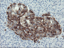 SERPINE2 Antibody in Immunohistochemistry (Paraffin) (IHC (P))