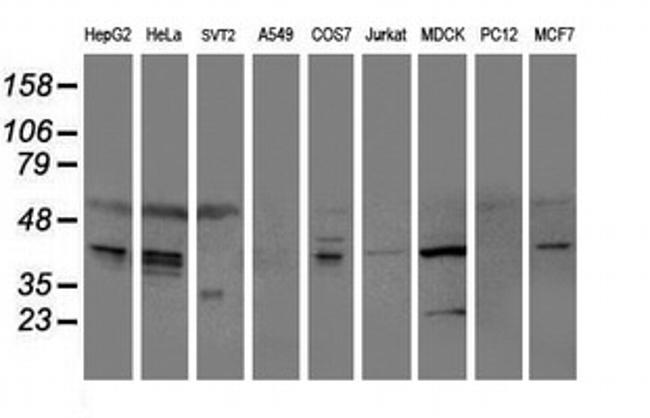 SERPINE2 Antibody in Western Blot (WB)