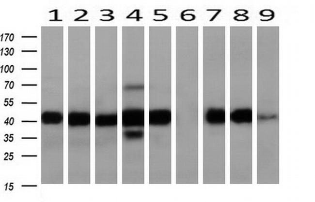 SERPINE2 Antibody in Western Blot (WB)