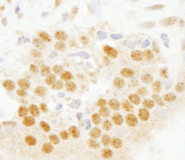 SET7 Antibody in Immunohistochemistry (IHC)