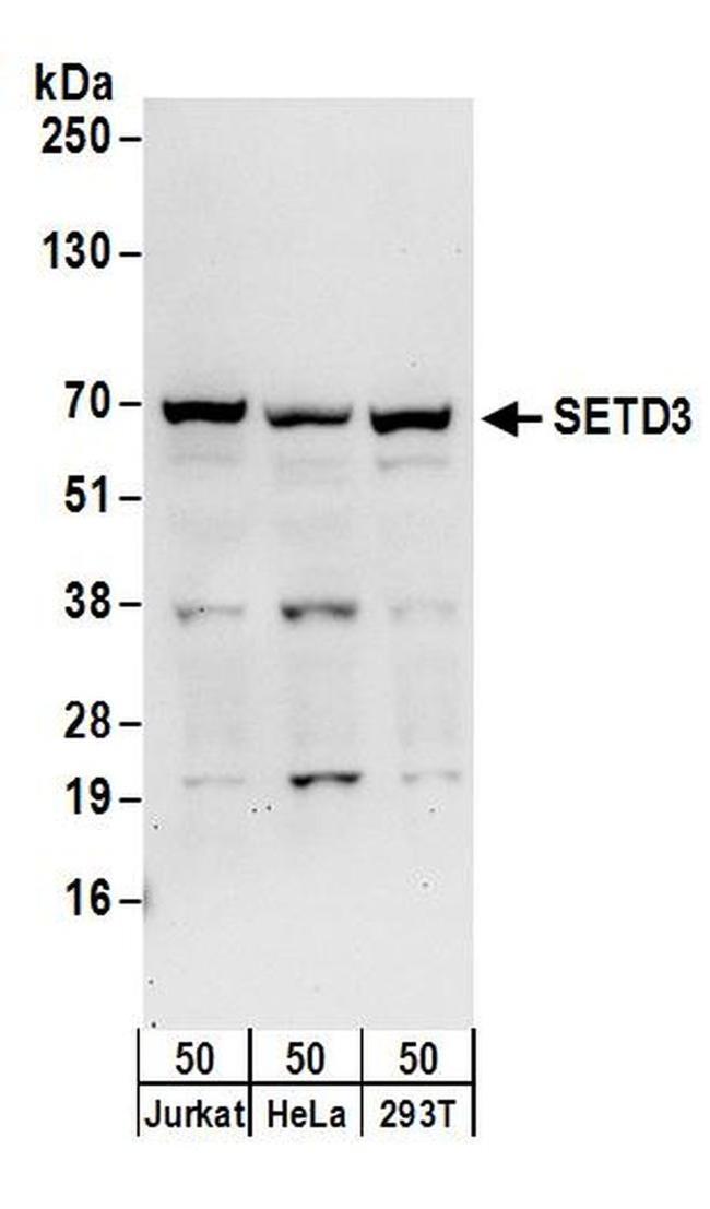 SETD3 Antibody in Western Blot (WB)