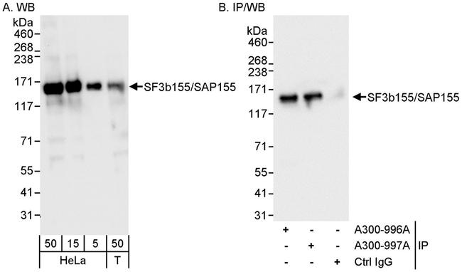 SF3b155/SAP155 Antibody in Western Blot (WB)