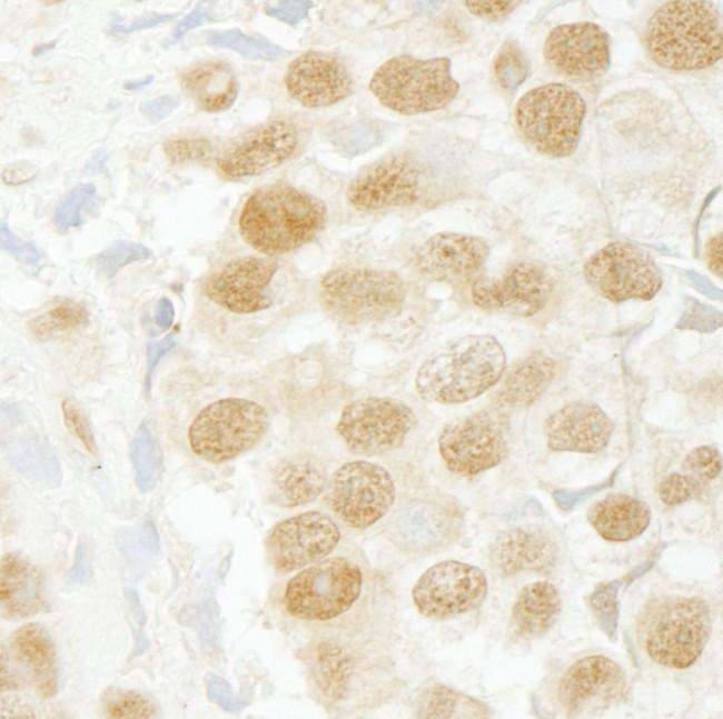 SFRS2IP Antibody in Immunohistochemistry (IHC)