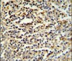 SGF29 Antibody in Immunohistochemistry (IHC)