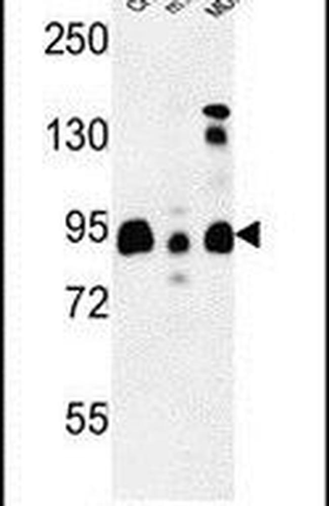 SGIP1 Antibody in Western Blot (WB)