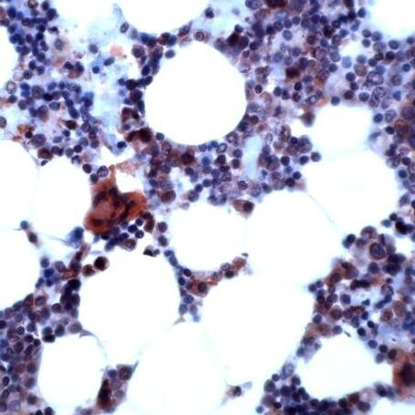 SHP2 Antibody in Immunohistochemistry (IHC)