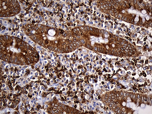 SH3BP1 Antibody in Immunohistochemistry (Paraffin) (IHC (P))