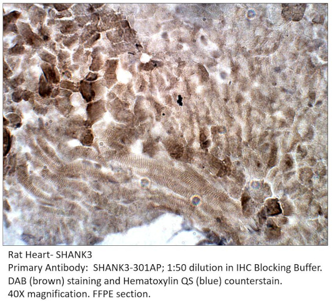 SHANK3 Antibody in Immunohistochemistry (IHC)
