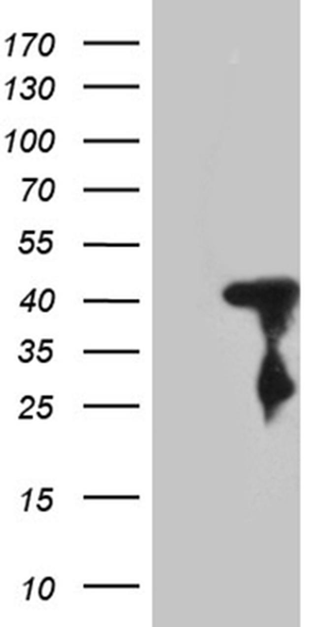 SHARPIN Antibody in Western Blot (WB)