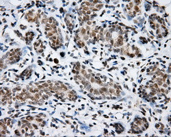 SHC1 Antibody in Immunohistochemistry (Paraffin) (IHC (P))