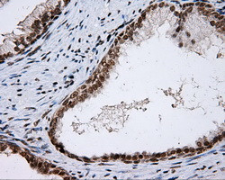 SHC1 Antibody in Immunohistochemistry (Paraffin) (IHC (P))