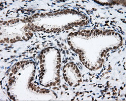 SHC1 Antibody in Immunohistochemistry (Paraffin) (IHC (P))