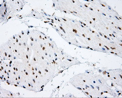 SHC1 Antibody in Immunohistochemistry (Paraffin) (IHC (P))