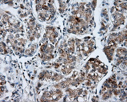 SHC1 Antibody in Immunohistochemistry (Paraffin) (IHC (P))