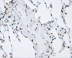 SHC1 Antibody in Immunohistochemistry (Paraffin) (IHC (P))