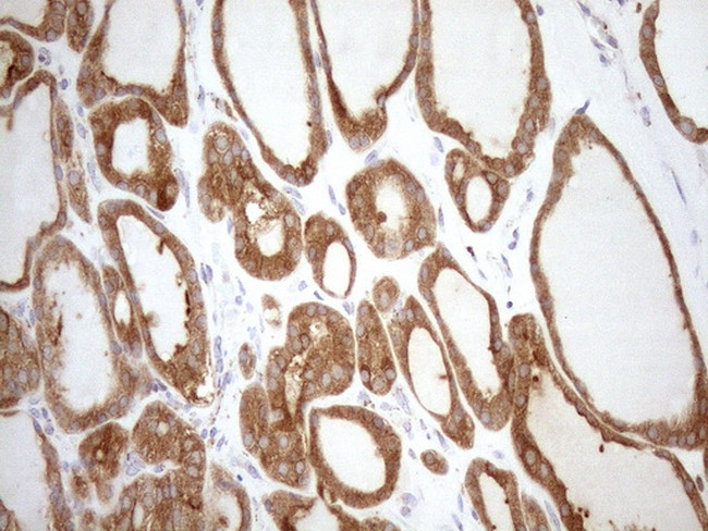 SHMT2 Antibody in Immunohistochemistry (Paraffin) (IHC (P))