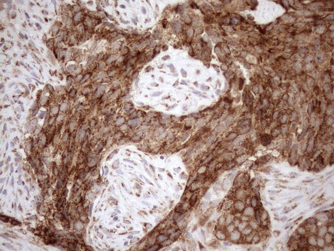 SHMT2 Antibody in Immunohistochemistry (Paraffin) (IHC (P))