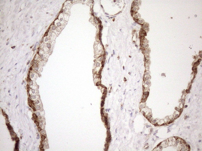 SHMT2 Antibody in Immunohistochemistry (Paraffin) (IHC (P))