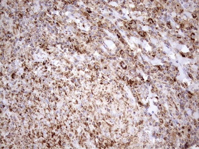 SHMT2 Antibody in Immunohistochemistry (Paraffin) (IHC (P))