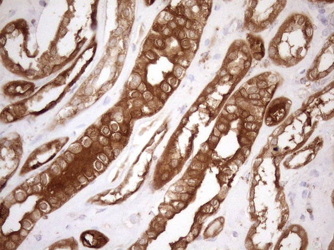 SHMT2 Antibody in Immunohistochemistry (Paraffin) (IHC (P))