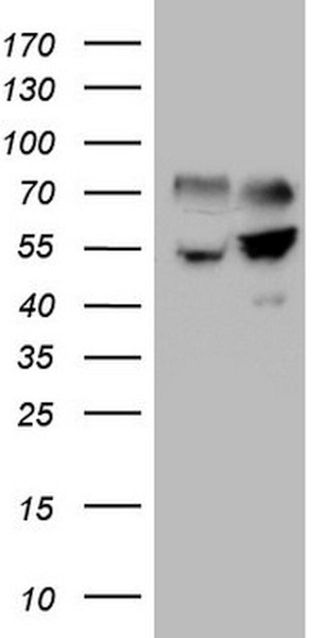 SHMT2 Antibody in Western Blot (WB)